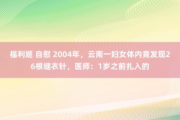 福利姬 自慰 2004年，云南一妇女体内竟发现26根缝衣针，医师：1岁之前扎入的